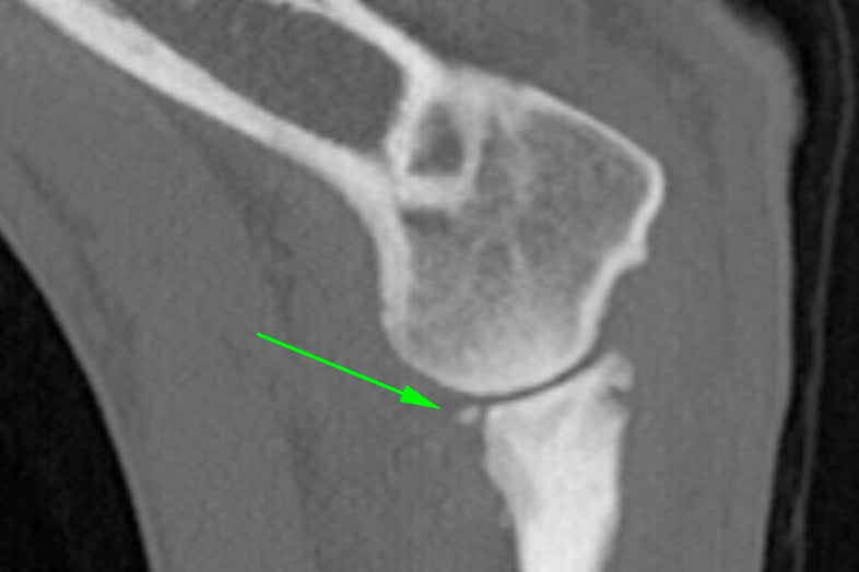 A side view CT-Scan image showing FCP of the elbow in a young dog