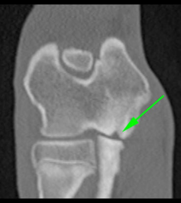 CT Scan of a dog elbow with osteochondrosis