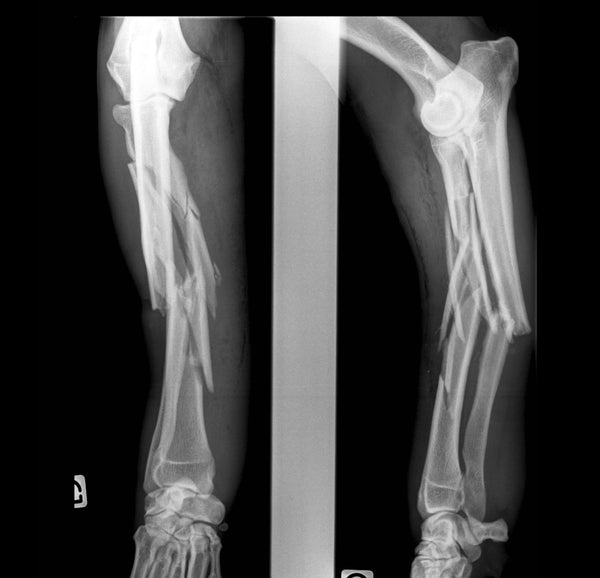 X ray of dog bone fracture