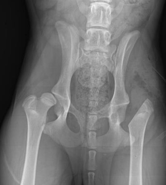 A post-surgery x-ray shows a femoral head osteotomy (FHO) in a young adult dog