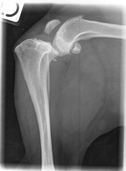 An x-ray showing a side view of a ruptured cruitiate ligament in an adult dog . The patella isn't in its normal position.