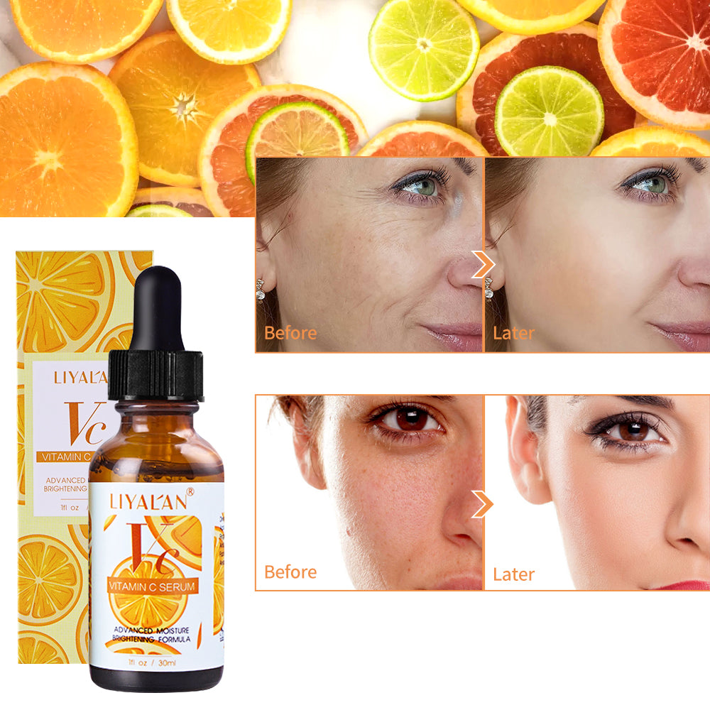 Best Vitamin C Serum For Face Skincare Antioxidant Anti Wrinkle – LIYAL'AN