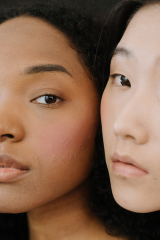 alt="Black girl with acne and asian girl looking over her shoulder."