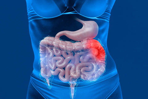 Bulimia Damages Esophagus-1