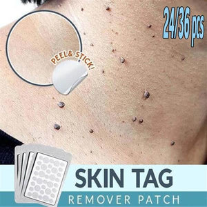 (50% OFF) Skin Tag Remover Patch-myBeauty US
