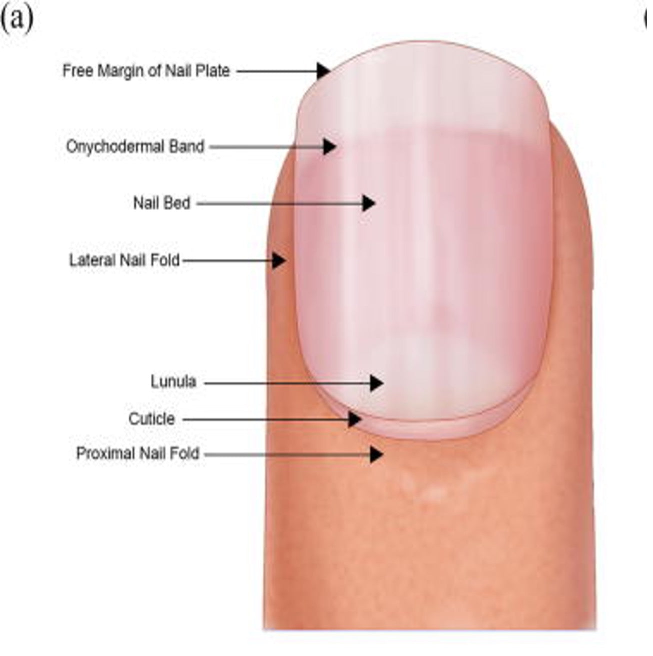 Frontiers | Case report: Novel use of the conventional method- chemical nail  avulsion may be effective for treatment of green nail syndrome