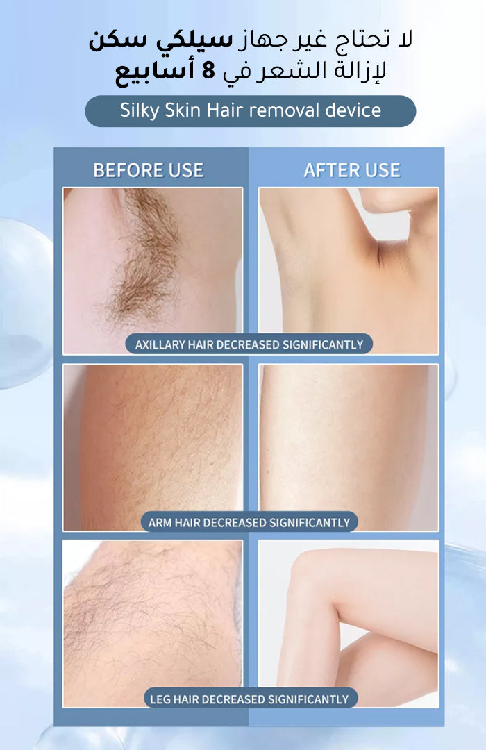 جهاز ازالة الشعر بالليزر المنزلي مع عدسات إضافية - Silky Skin Plus Hair Removal laser