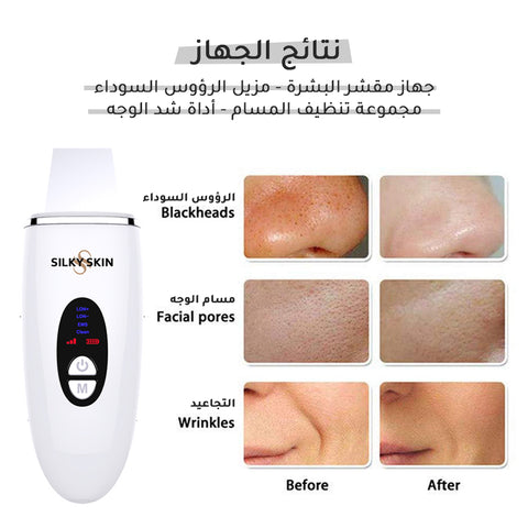 Skin Scrubber - Blackhead Remover - Pore Cleansing Kit - Face Lifting Tool
