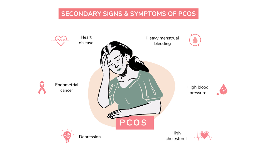 Signs & symptoms of PCOS