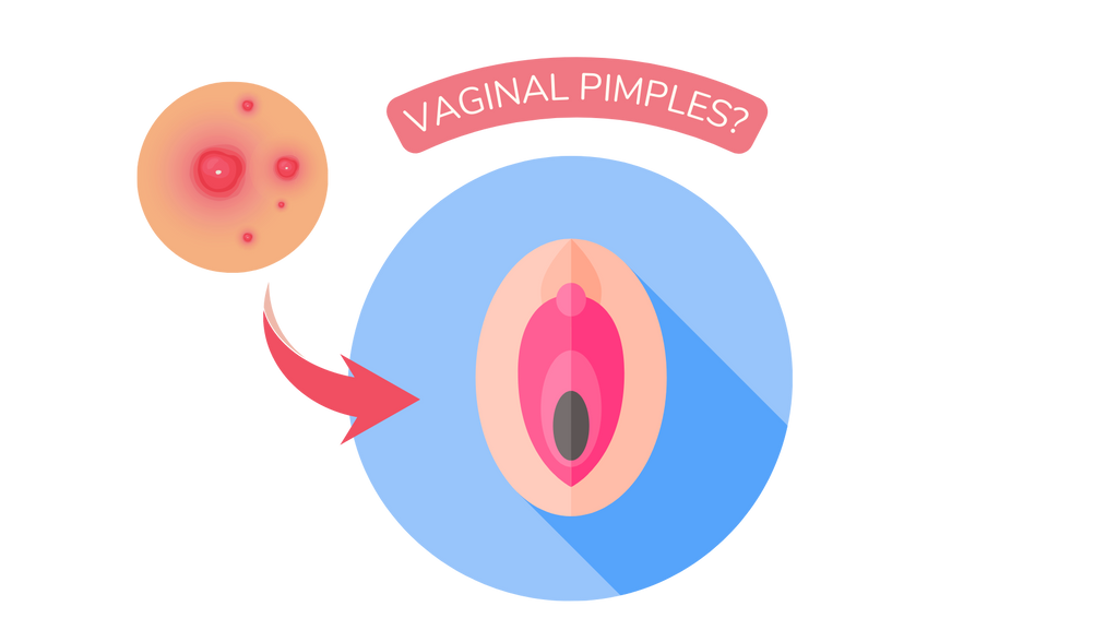 VAGINAL-PIMPLES