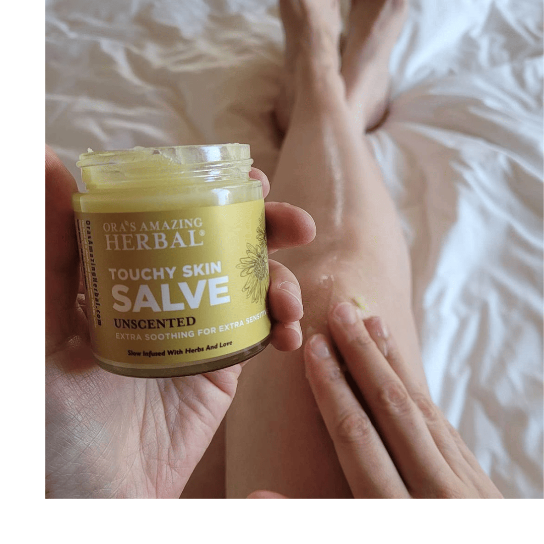 Touchy Skin Salve as an Alternative for Eczema in Kids and Adults