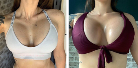 Breast Enhancement Patches – KoreaBlush