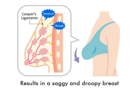 New Fiitobeauty Breast Enhancement Patch, Breast Enhancement Patch For  Women