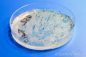 petri-dish-colonies-microorganisms-33055930