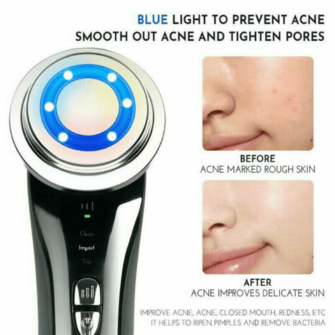 acne treatment