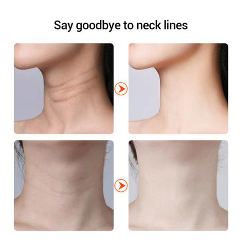 neck lift