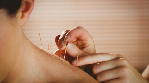 Acupuncture Treatment For Allergies 