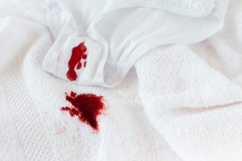 How to remove period blood stains