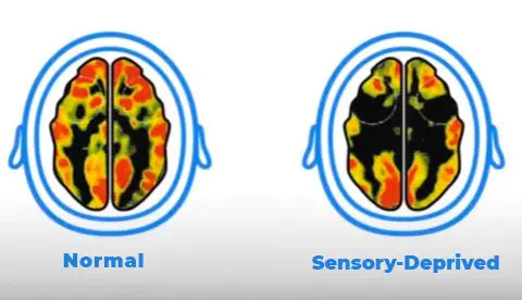 how screens affect the brain2