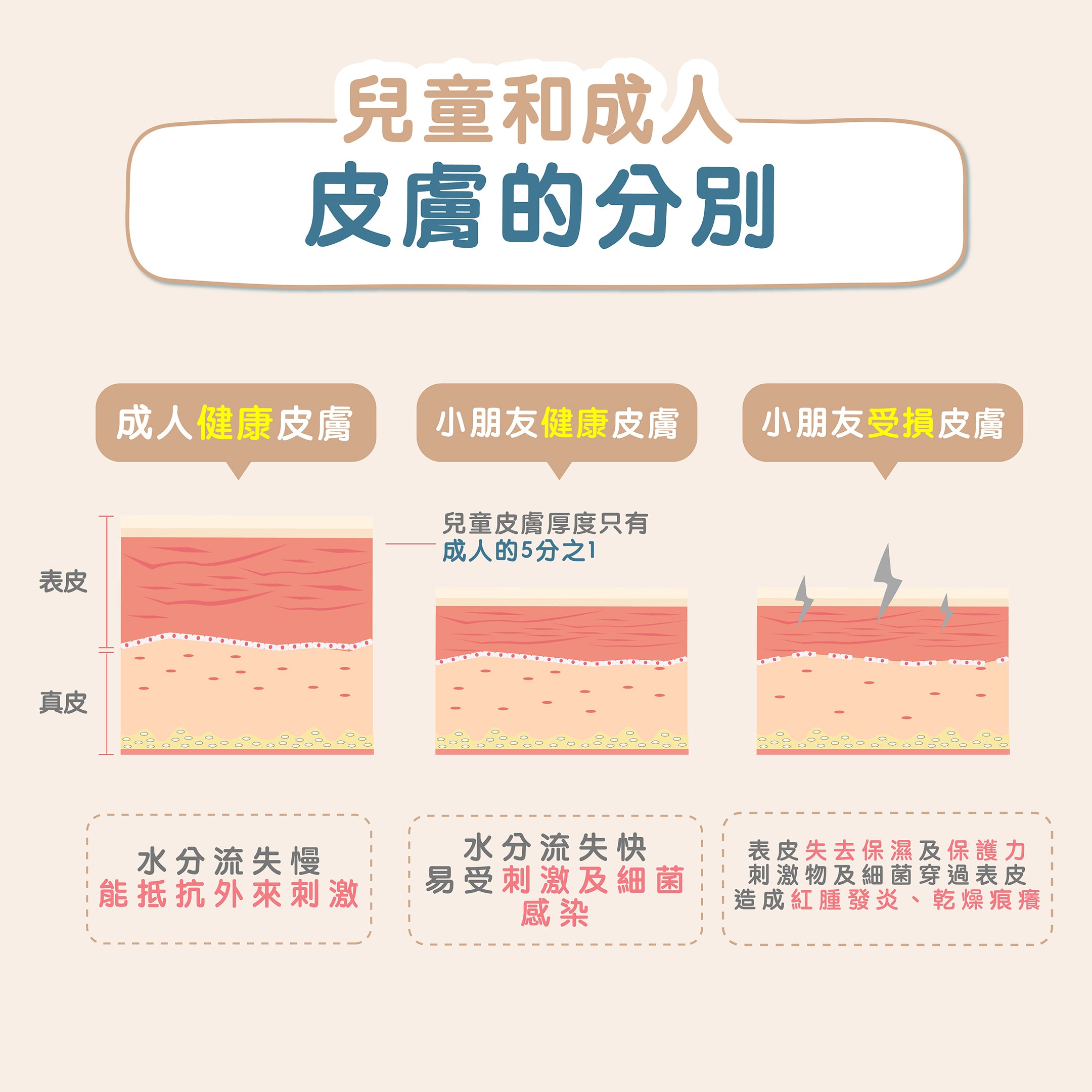 兒童和成人皮膚及濕疹徵狀大不同