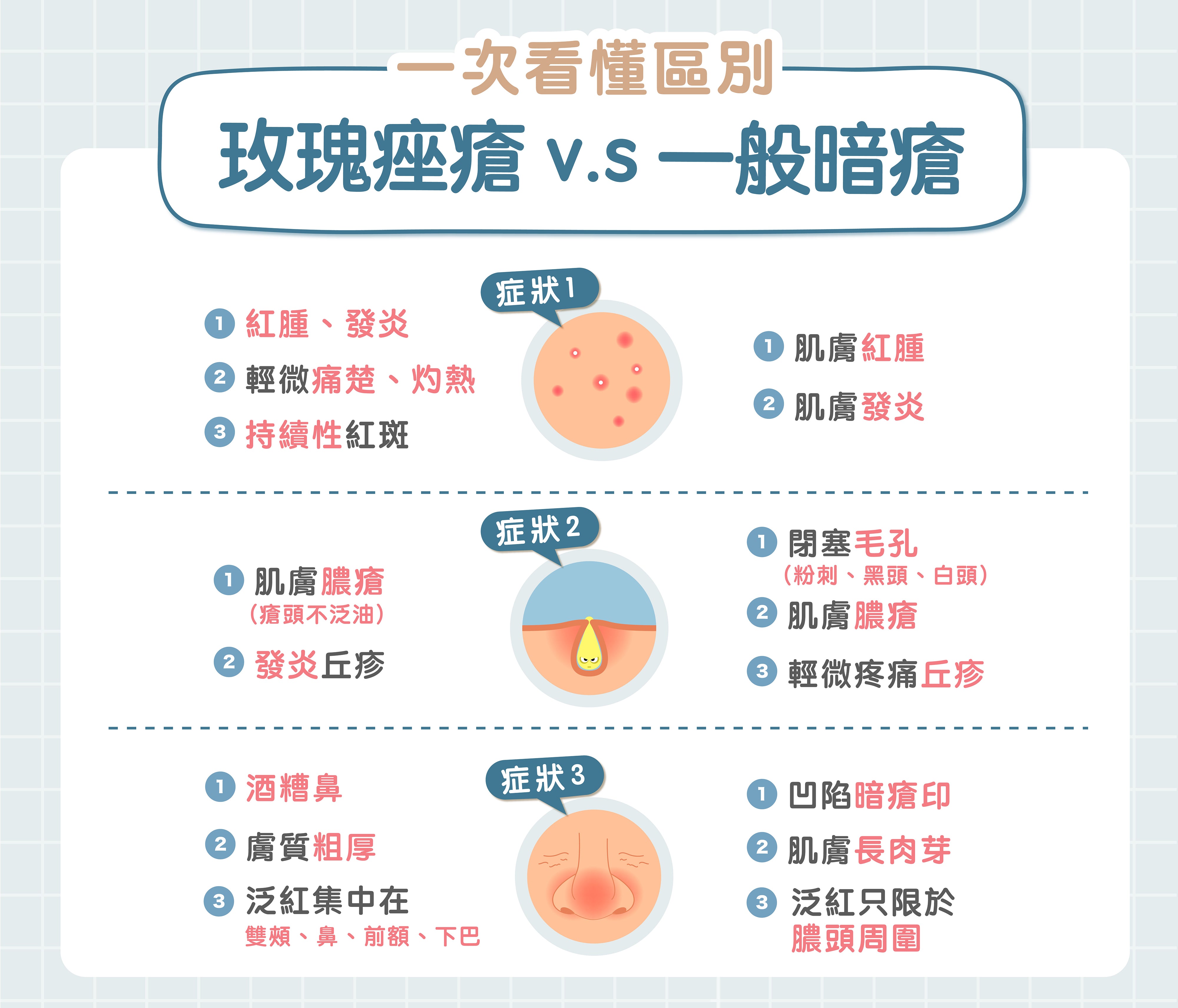 玫瑰痤瘡與暗瘡的不同徵狀