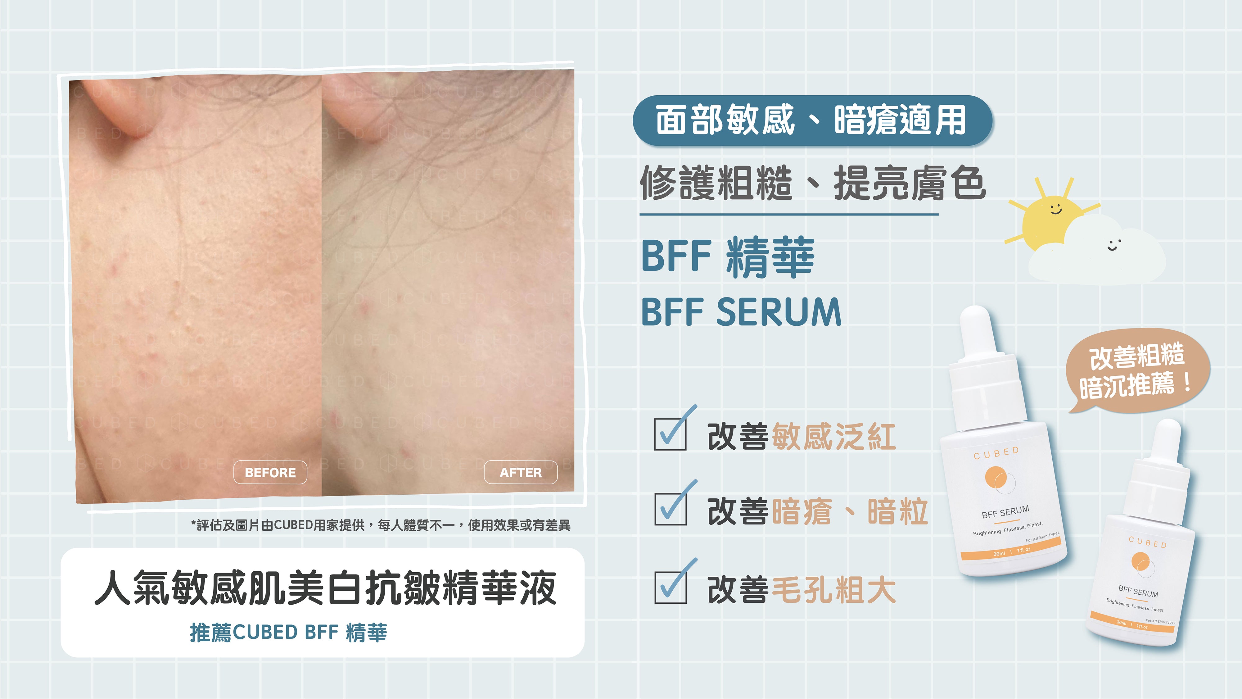  CUBED BFF精華改善敏感泛紅、暗粒、毛孔粗大肌膚