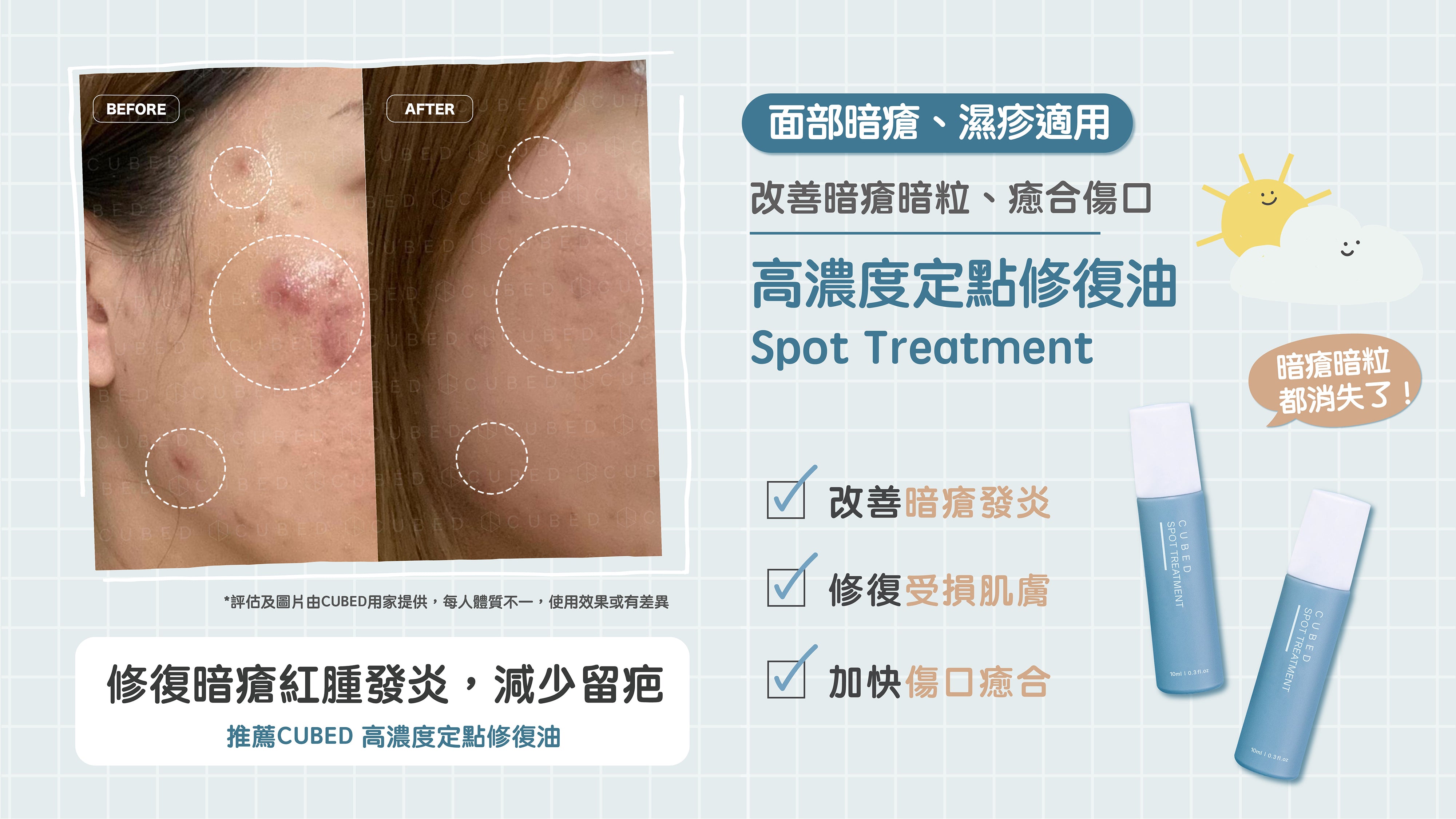 CUBED 高濃度定點修復油改善暗瘡暗粒、膿瘡肌膚