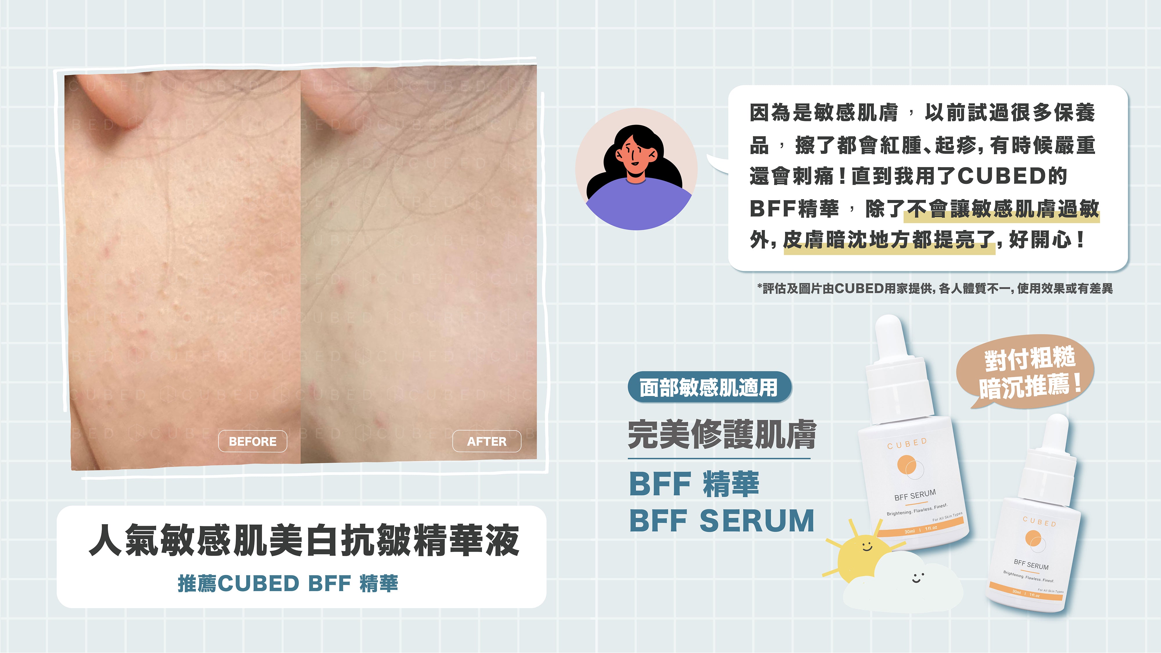 CUBED BFF 精華急救鎮靜皮膚敏感、紅疹粒粒精華推薦