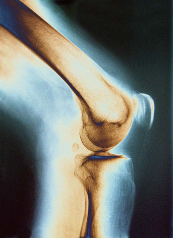 bone & joint health knee