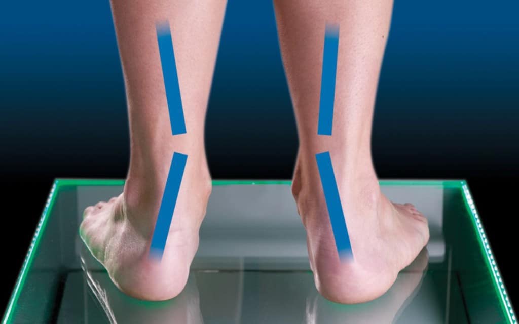 over supination pronation