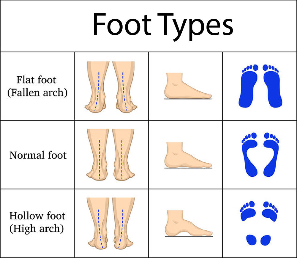 Supination in feet and exercises to correct it