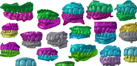 Denture scans we tailored to