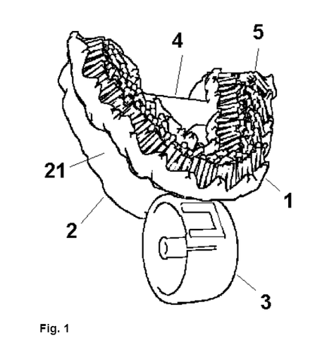 Blizzident First Patent Application