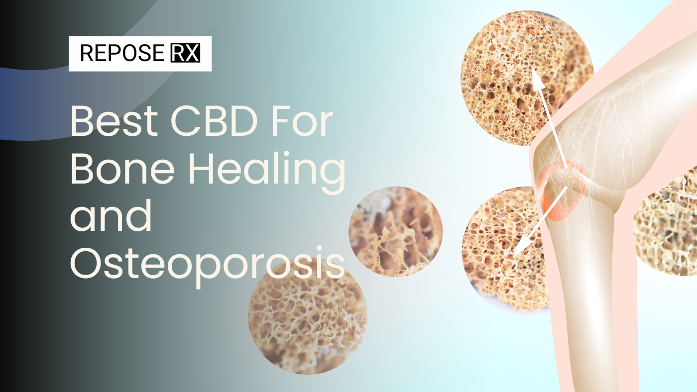 Best CBD For Bone Healing and Osteoporosis