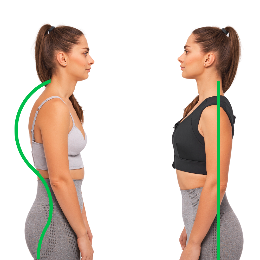Can posture improve double chin?