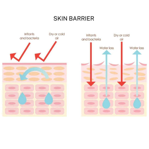 skin barrier