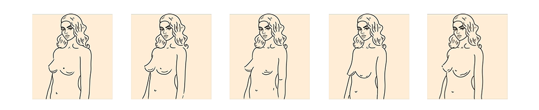 An illustration of breast shapes