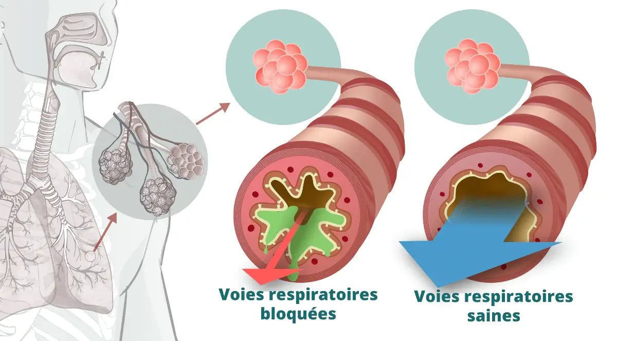 Avant après airphysio