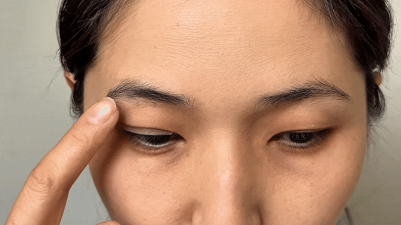 Smoothing the upper eyelid skin down in a gentle arc on the F-tape