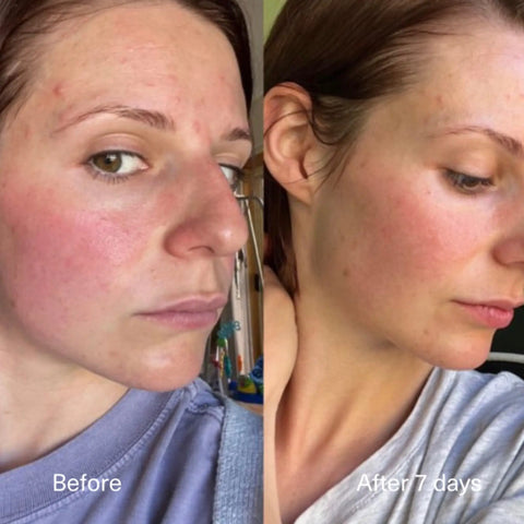 Before and after 7-day results using Muse By Gaia The Potion Milky Emulsion, showcasing refined skin texture, reduced redness, and brighter skin. Available at VAMS Beauty, offering natural Australian made skincare solutions