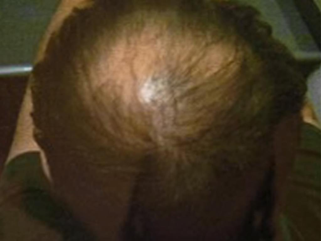 Shampoo Tricogym prima uomo
