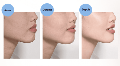 Período de uso do Sérum vitamina C