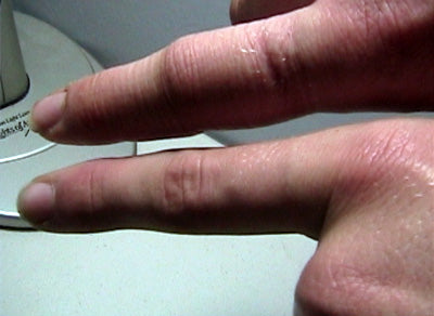 Jujimufu's broken finger