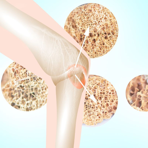 Illustration of a knee joint with bones stacked on top of each other.