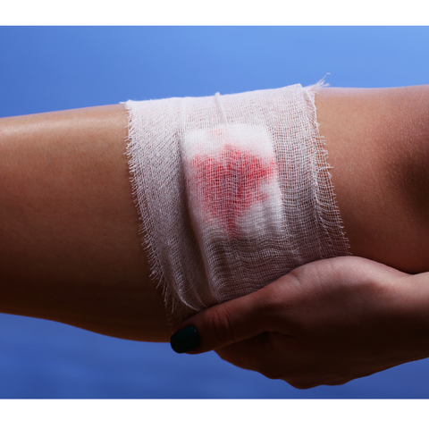 A person's arm wrapped in a bandage, suggesting impaired wound healing.