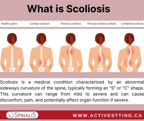 What is Scoliosis