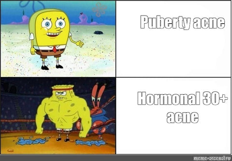 funny meme about hormonal acne and acne caused by stress