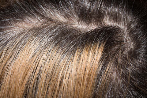 Woman’s hair whorl