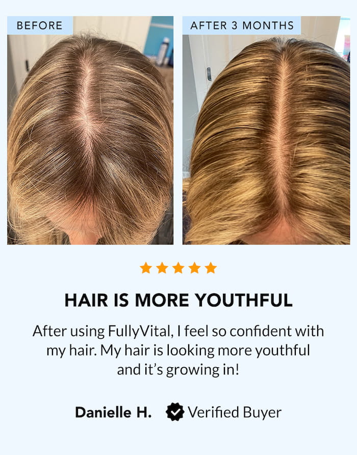 FullyVital: Natural Hair Growth Products Based On Science | FullyVital