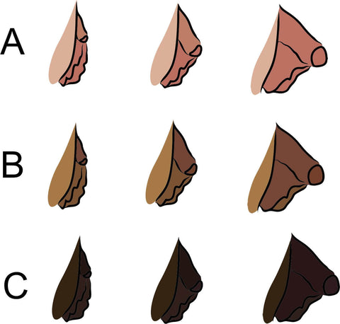 FTM bottom growth